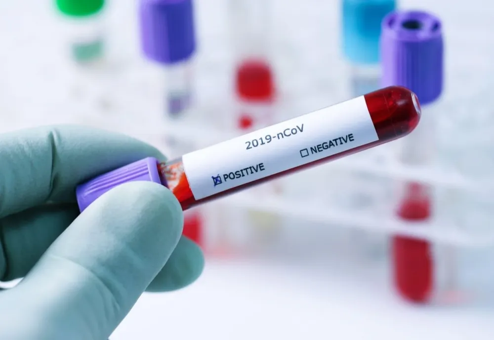 Încă 59 de persoane confirmate cu SARS Cov-2 înregistrate în județul Brăila