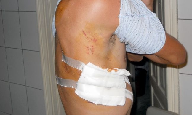 O brăileancă și-a înjunghiat concubinul, cu 11 ani mai tânăr! Ambii consumaseră băuturi alcoolice!