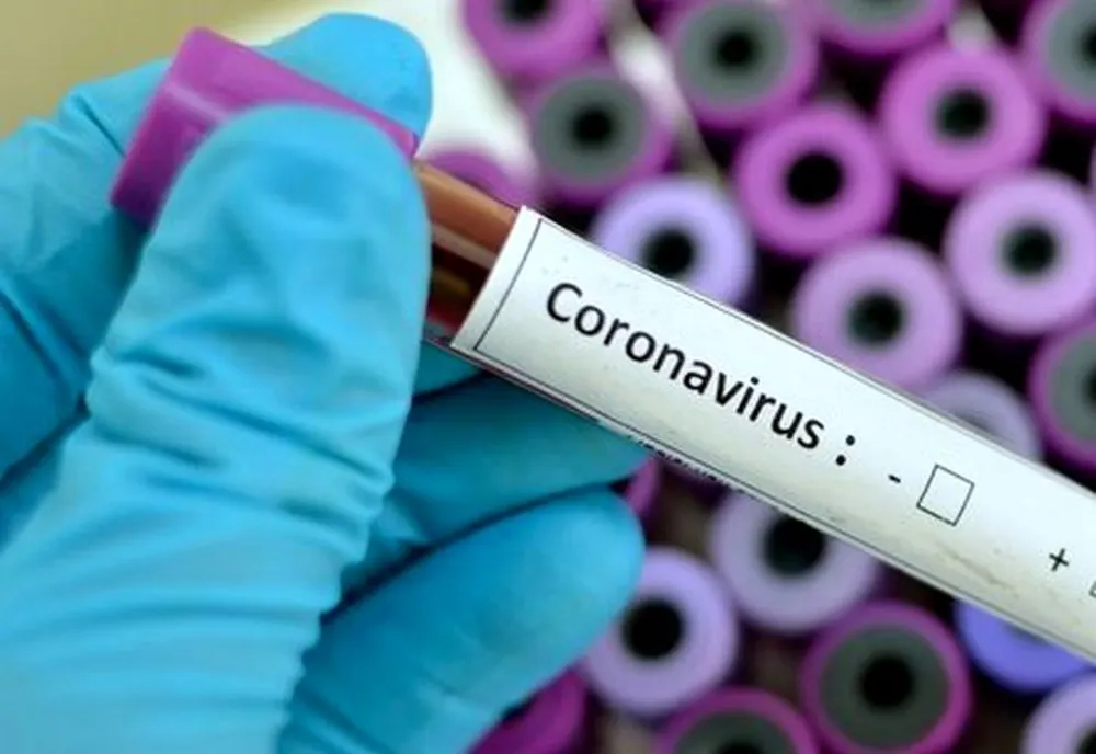 79 de cazuri confirmate cu COVID-19 până la ora 17.00