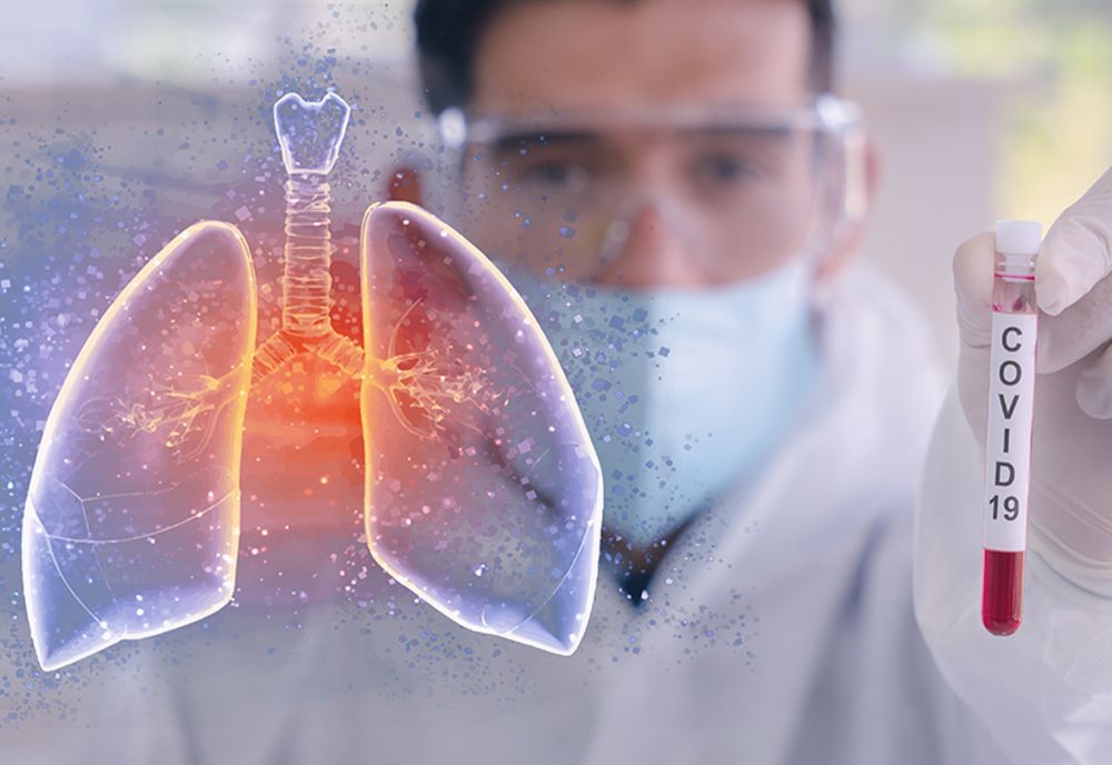 Crește numărul cazurilor de infectare cu noul coronavirus și la Brăila