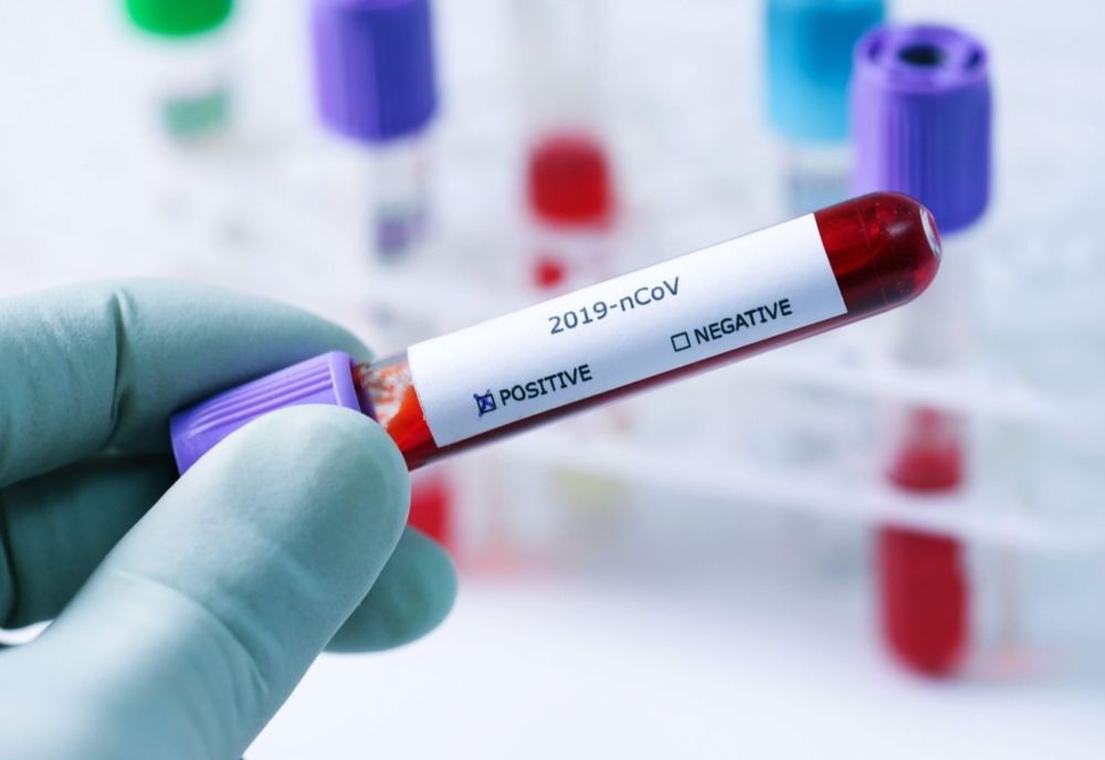 Încă 59 de persoane confirmate cu SARS Cov-2 înregistrate în județul Brăila