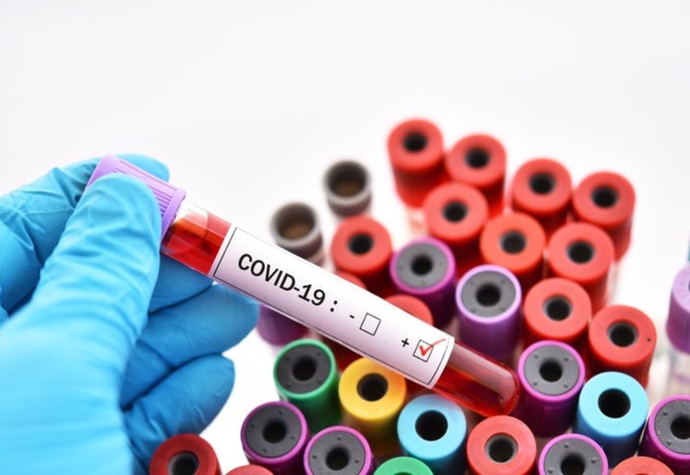 Bilanț coronavirus 20 aprilie: 2.931 cazuri noi, 237 de DECESE