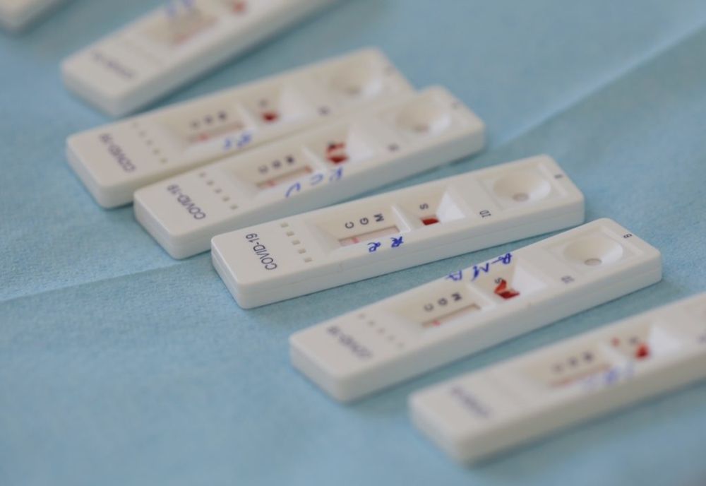 Care este gradul de pozitivare pentru testele COVID. Anunțul Ministerului Sănătăţii